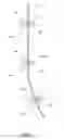Fig. 02 - Strap For Use In Shutter Installations And Method Of Using The Same