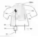 Fig. 01 - Devices and methods related to radiation delivery