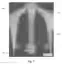 Fig. 06 - Devices and methods related to radiation delivery