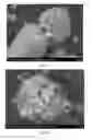 Fig. 07 - Methods and compositions using calcium carbonate