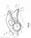 Fig. 05 - Engine rocker arm
