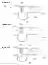 Fig. 16 - Respiratory secretion retention device, system and method