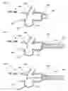Fig. 19 - Respiratory secretion retention device, system and method