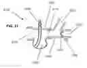 Fig. 22 - Respiratory secretion retention device, system and method