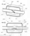 Fig. 26 - Respiratory secretion retention device, system and method