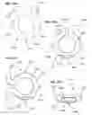 Fig. 32 - Respiratory secretion retention device, system and method