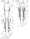 Fig. 41 - Respiratory secretion retention device, system and method