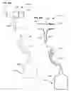 Fig. 48 - Respiratory secretion retention device, system and method