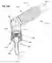 Fig. 53 - Respiratory secretion retention device, system and method