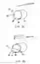 Fig. 07 - Nasal devices for use while sleeping