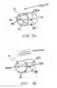 Fig. 08 - Nasal devices for use while sleeping