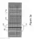 Fig. 04 - HAIR EXTENSION DEVICE