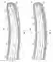 Fig. 02 - Flexible directional drilling apparatus and related methods