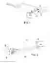Fig. 02 - Angular adjusting system for torsion suspension and torsion suspension so obtained
