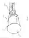 Fig. 40 - Hybrid component