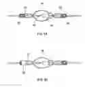 Fig. 02 - Method for assembling a socket for a discharge lamp and discharge lamp