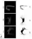 Fig. 03 - Catheter RF ablation using segmentation-based 2D-3D registration