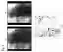 Fig. 05 - Catheter RF ablation using segmentation-based 2D-3D registration
