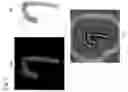 Fig. 06 - Catheter RF ablation using segmentation-based 2D-3D registration