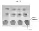 Fig. 03 - Liquid crystal display