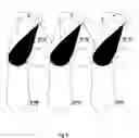 Fig. 06 - Vortical wind energy apparatus