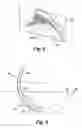 Fig. 06 - Electrochemical machining assembly with curved electrode