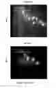 Fig. 35 - METHODS AND COMPOSITIONS FOR TREATING ATHEROSCLEROSIS AND RELATED CONDIDTIONS