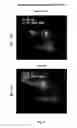 Fig. 43 - METHODS AND COMPOSITIONS FOR TREATING ATHEROSCLEROSIS AND RELATED CONDIDTIONS