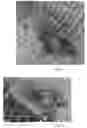 Fig. 02 - THERAPEUTIC COMPOSITION FOR ATOPIC DERMATITIS