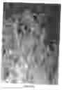 Fig. 16 - Cancellous constructs, cartilage particles and combinations of cancellous constructs and cartilage particles