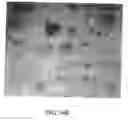 Fig. 17 - Cancellous constructs, cartilage particles and combinations of cancellous constructs and cartilage particles
