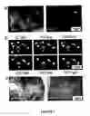 Fig. 07 - Method for differentiating embryonic stem cells into cells expressing AQP-1