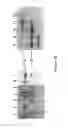Fig. 17 - Wheat with altered branching enzyme activity and starch and starch containing products derived therefrom