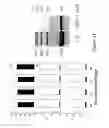 Fig. 21 - Wheat with altered branching enzyme activity and starch and starch containing products derived therefrom