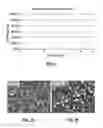 Fig. 07 - Apparatus and methods for loading a drug eluting medical device