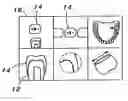 Fig. 01 - Dental prosthesis manufacturing process, dental prosthesis pattern and dental prosthesis made thereby