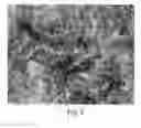 Fig. 03 - Enriched pancreatic stem cell and progenitor cell populations, and methods for identifying, isolating and enriching for such populations