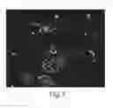 Fig. 08 - Enriched pancreatic stem cell and progenitor cell populations, and methods for identifying, isolating and enriching for such populations