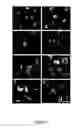 Fig. 02 - Monocyte-Derived Stem Cells (MDSC) and Methods of Use Thereof