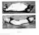 Fig. 11 - Biomimetic cell scaffolds