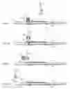 Fig. 05 - Golf swing training aid