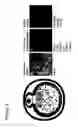 Fig. 03 - METHODS AND DEVICES FOR ASSESSING INFERTILITY AND/OR EGG QUALITY