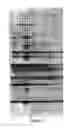 Fig. 06 - MATRIX SCREENING METHOD