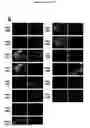 Fig. 35 - METHODS AND COMPOSITIONS FOR TRANSLATIONAL PROFILING AND MOLECULAR PHENOTYPING