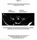 Fig. 45 - METHODS AND COMPOSITIONS FOR TRANSLATIONAL PROFILING AND MOLECULAR PHENOTYPING