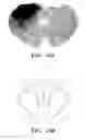 Fig. 22 - Method for treating stroke via administration of NEP1-40 and inosine