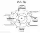 Fig. 19 - METHODS OF TREATING  HEPATIC ENCEPHALOPATHY