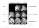 Fig. 01 - Transparent articles prepared from thermoplastic compositions having low birefringence