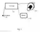 Fig. 02 - Hard-wired implanted controller system