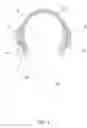 Fig. 02 - Method of determining a gain setting of a bone-anchored hearing aid